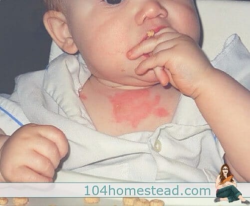 Kids get hurt a lot. Make sure you are equipped for injuries that go beyond the scope of mommy kisses. Check out this Natural First Aid Kit
